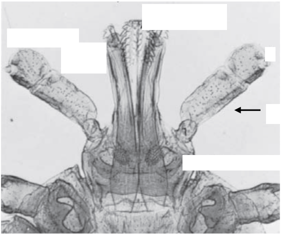 Identify the pointed structure