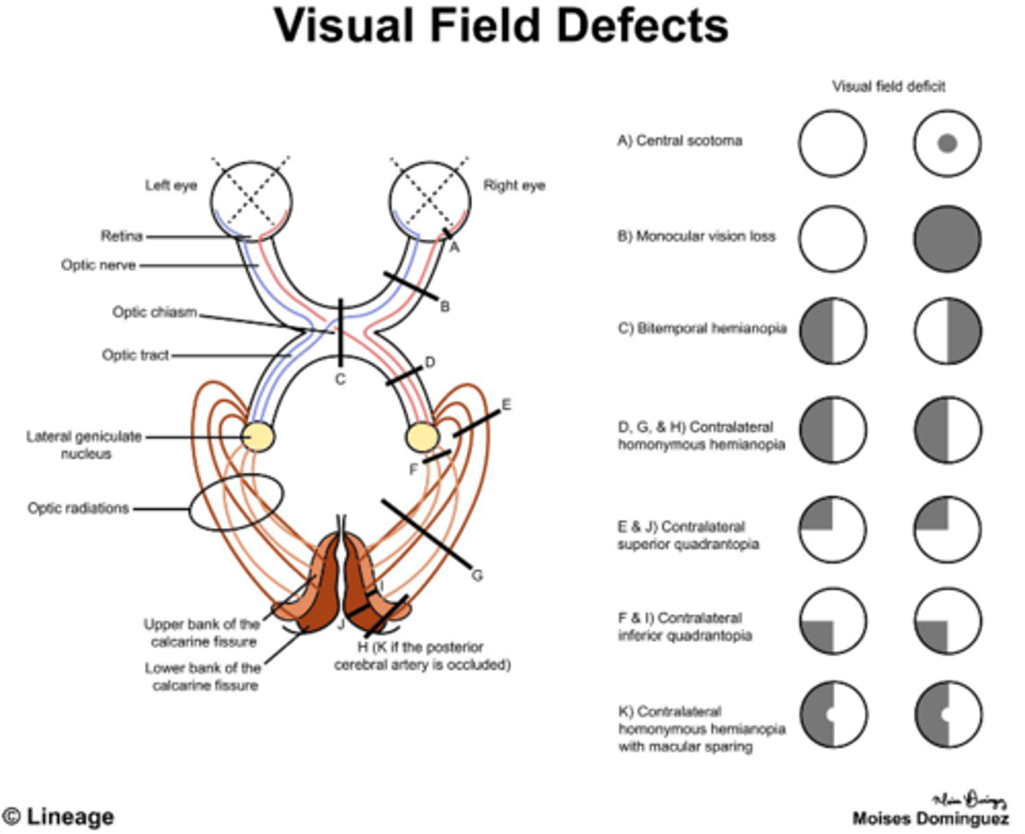 <p>Optic chiasm</p>
