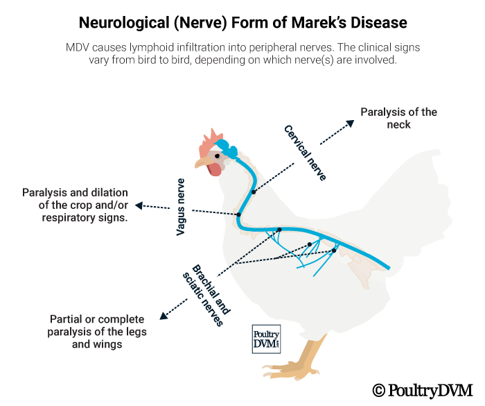 <p><strong>Marek`s Disease:</strong></p><ul><li><p><strong>caused </strong>by Gallid Alphaherpesvirus 2, in Poultry</p></li><li><p><strong>Transmission</strong>: Inhalation of infected dust, virus shed from feather follicles, Very contagious</p></li><li><p><strong>CS</strong>: <span style="color: purple;"><span>T-Cell Lymphomas + peripheral nerve enlargement (most typical)</span></span></p><ul><li><p>Lymphoid tumors, paralysis, <span style="color: purple;"><span>grey eye (blindness), death</span></span></p></li><li><p>Acute: depression, paralysis + death</p></li></ul></li><li><p><strong>Pathology</strong>: PM - enlarged nerves, Lymphoid tumors in various organs, <span style="color: purple;"><span>lesions at feather follicles</span></span></p></li></ul><ul><li><p><strong>Diagnosis</strong>:<span style="color: purple;"><span> Gross Necropsy + histopathology,</span></span> History + CS</p></li><li><p><strong>Treatment/Prevention:</strong> No treatment. Vaccination.</p></li></ul><p></p>