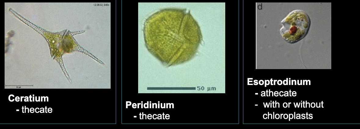 <p>What bacteria is this?</p>
