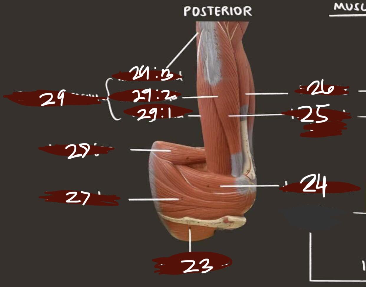 <p>Posterior arm number 29:2</p>
