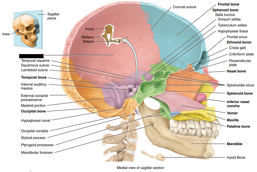 <p>State and identify what part of the cranial bone is being pointed out and censored. (hint: bones)</p>
