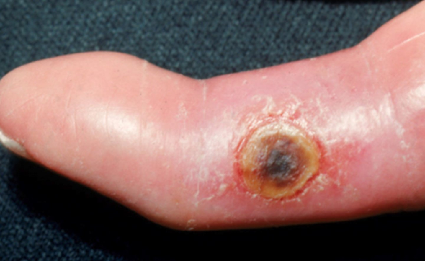<p>What is the diagnosis?</p>