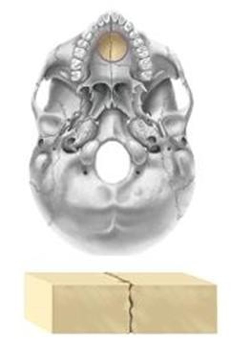 <p>straight, nonoverlapped</p>