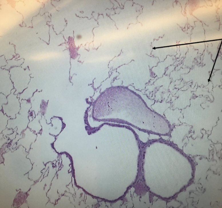 <ol><li><p><strong>Name this tissue type</strong></p></li><li><p><strong>Name a location<br>where you can find this tissue in<br>the body.</strong></p></li></ol><p></p>