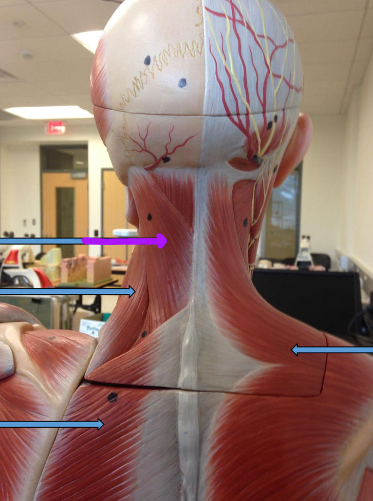 <p>Identify this muscle?</p>