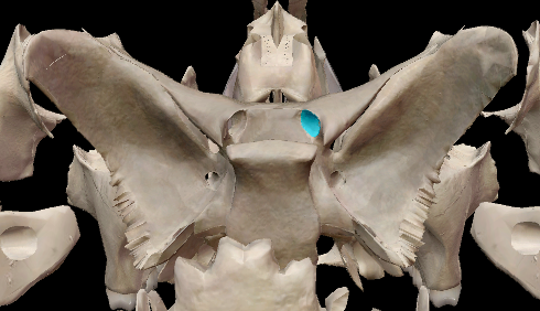 term image