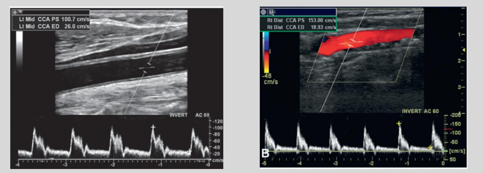 <p>what waveform is this</p>