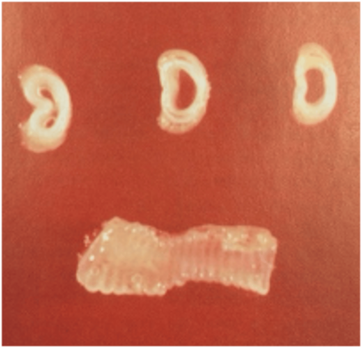 <p>the pathology of this turkey trachea combined w/ additional beak breathing likely indicates what pathogen</p>