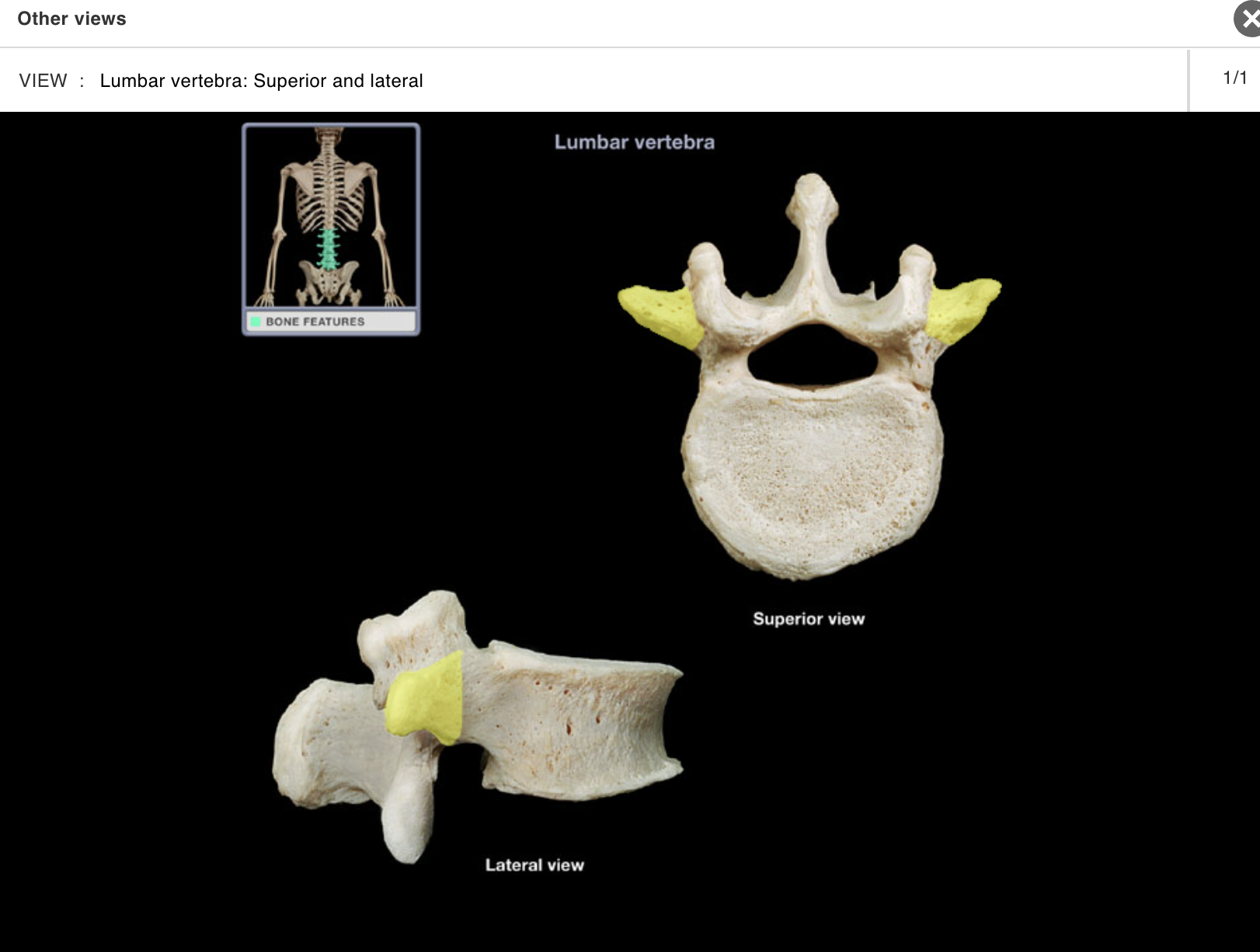 <p>Location:</p><p class="p1">• Lateral aspect of lumbar vertebra</p><p class="p1">Description:</p><p class="p1">• Prominent, paired, laterally-directed process</p><p class="p1">Comment:</p><p class="p1">• Provides attachment for intrinsic back muscles and ligaments</p>
