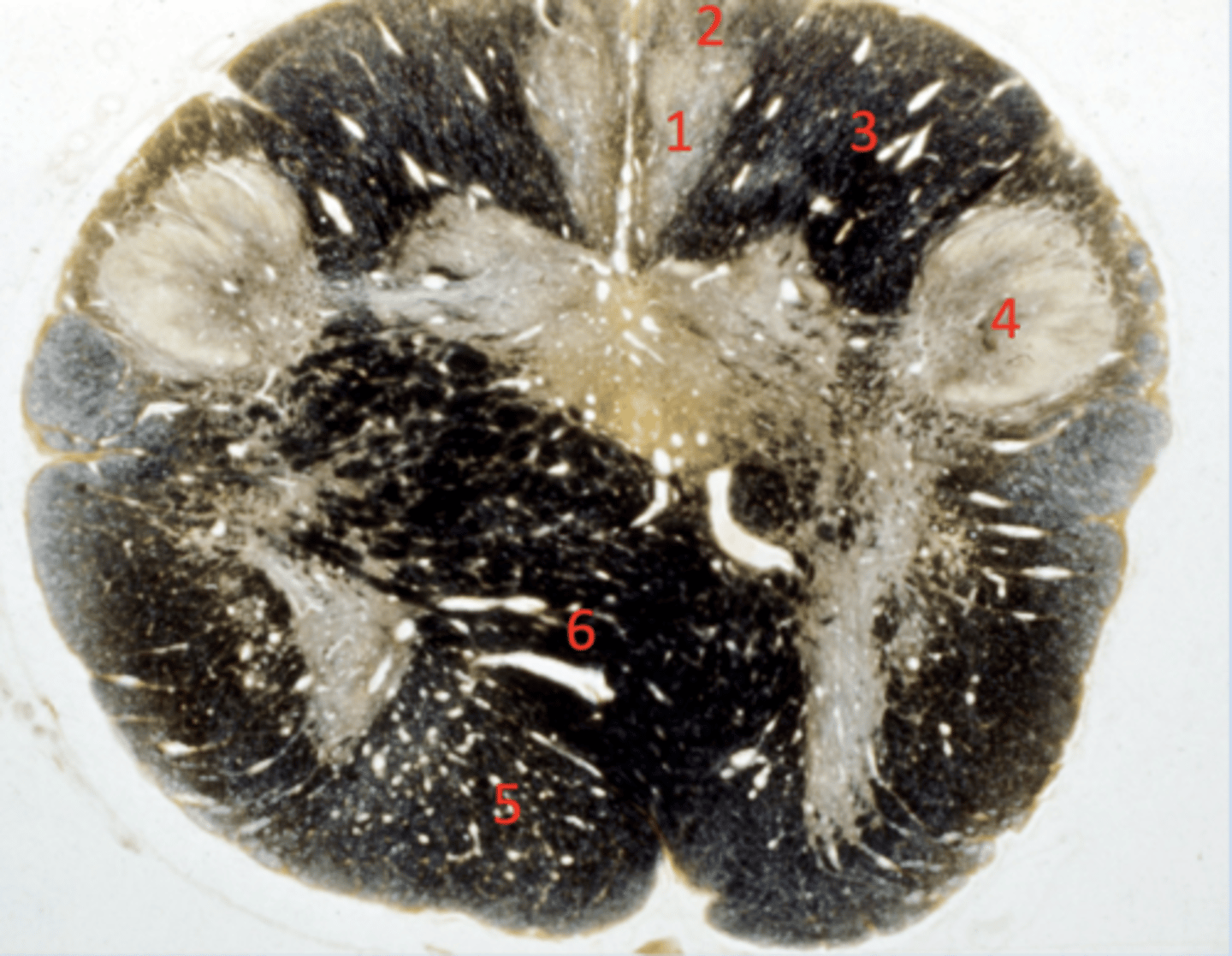 <p>gracile fasiculus (caudal)</p>