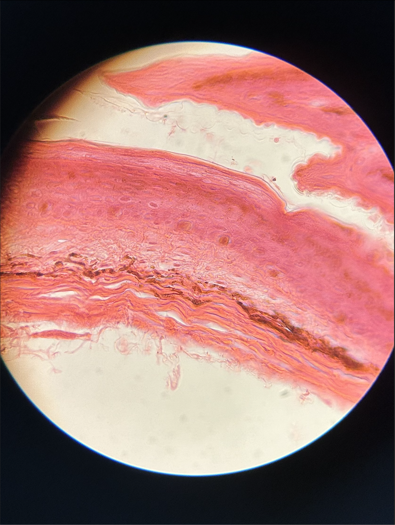 <p>what specimen is this?</p><p>identify the type of scale, chromatophores, and muscle</p>