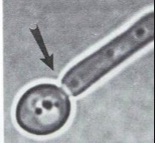 <p>What is the results of this germ tube?</p>