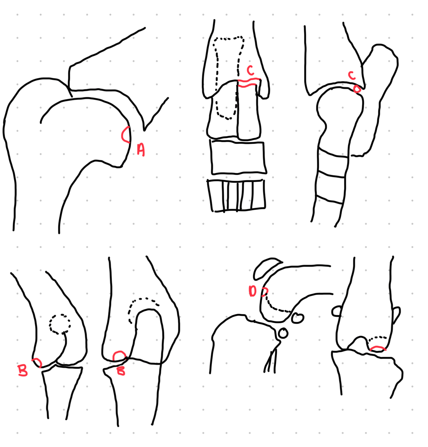 <p>which OCD lesions are these in the dog</p>