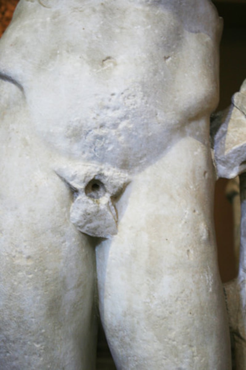 <p>Castrated male</p>