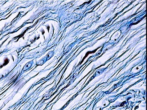 <p>Is this fibrocartilage, hyaline cartilage, or elastic cartilage?</p>