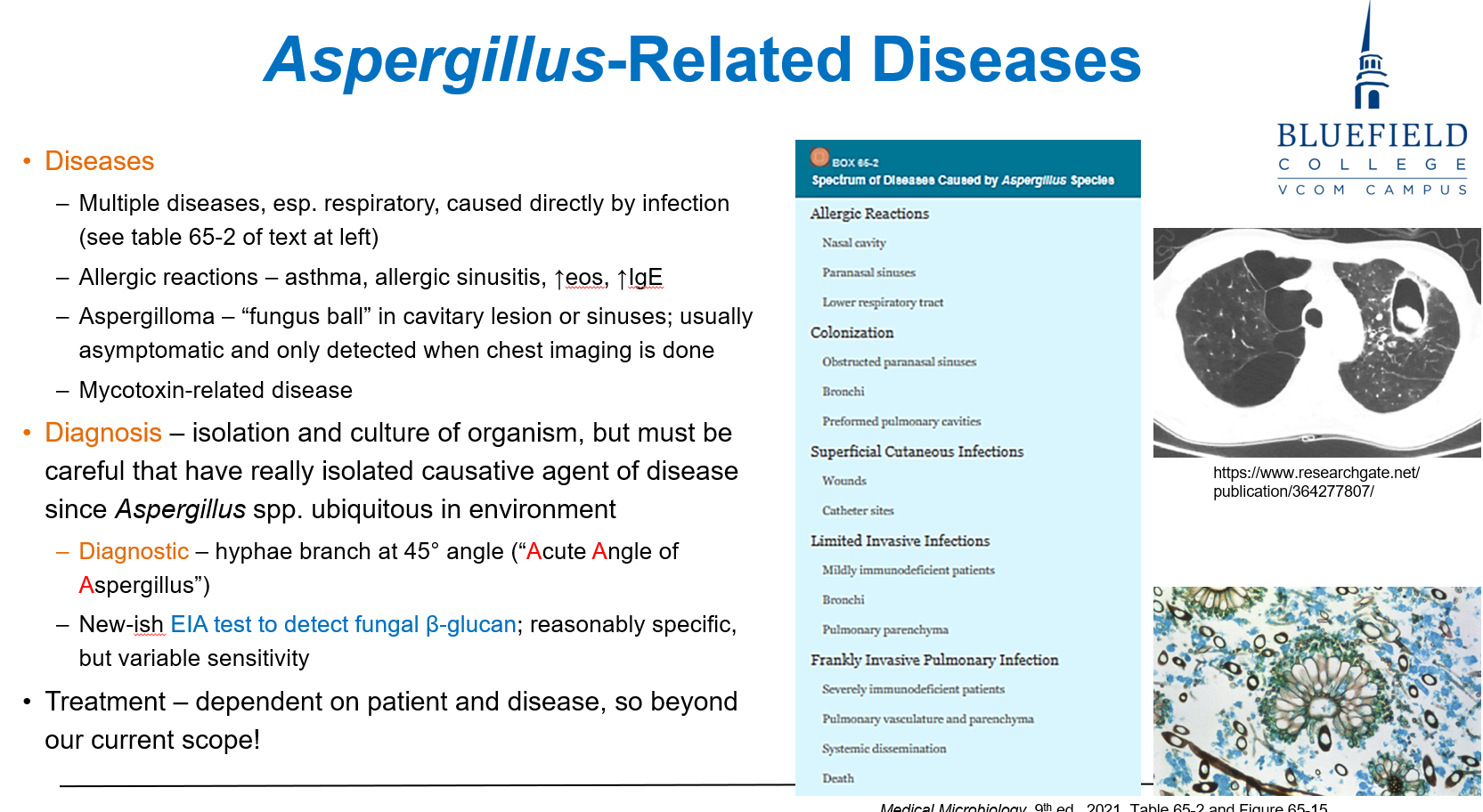 <p>B. Allergic bronchopulmonary aspergillosis<br></p><p><em>Aspergillus</em> can cause <strong>hypersensitivity reactions</strong> including <strong>allergic bronchopulmonary disease</strong>.</p>