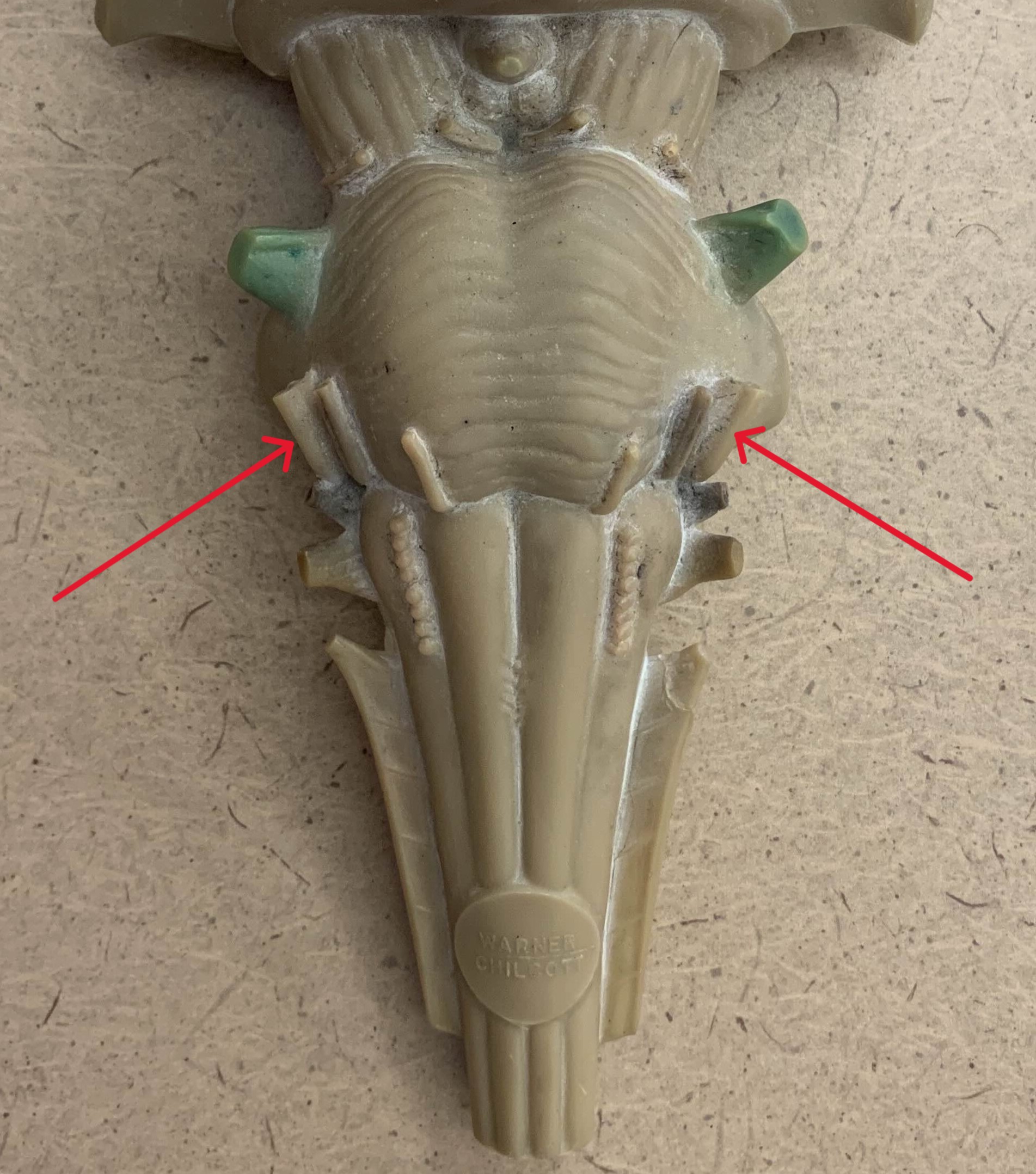 <p>Which nerve of the brain is:</p><ul><li><p>Side of pons</p></li><li><p>Lateral to facial nerve</p></li></ul><p></p>