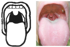 <p>classify</p>