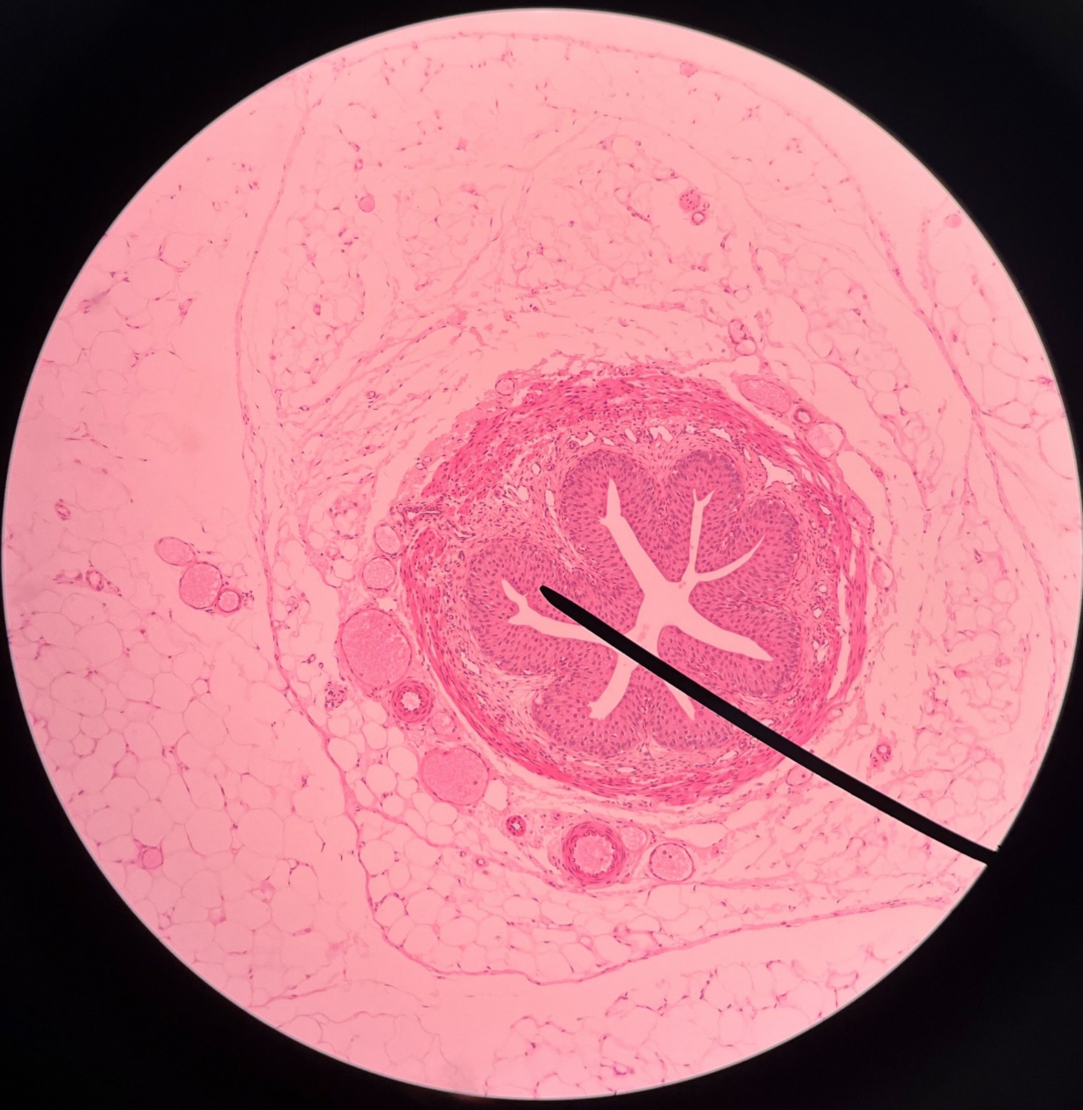 • Slide histology of the ureter.

• The innermost layer of the ureter.

• Composed of urothelium.

• Faces the lumen of the ureter and is deep to the longitudinal layer of the muscularis.