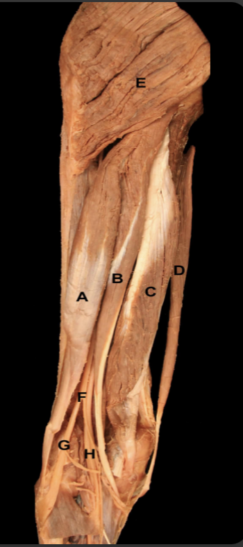 <p>Which muscle pictured are considered “hamstrings”? </p>