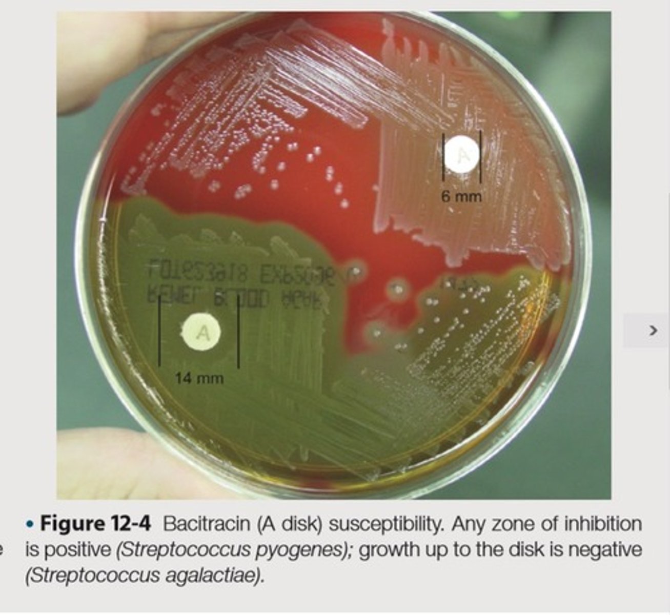 <p>This is the organism and its expected results for the quality control of Bacitracin Susceptibility to exhibit negative results</p>
