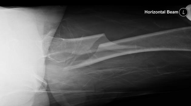 <p>Describe the abnormality demonstrated. </p>