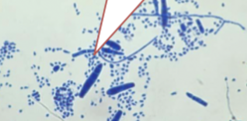 <p>lots of microconidia, cigar-shaped macroconidia</p>