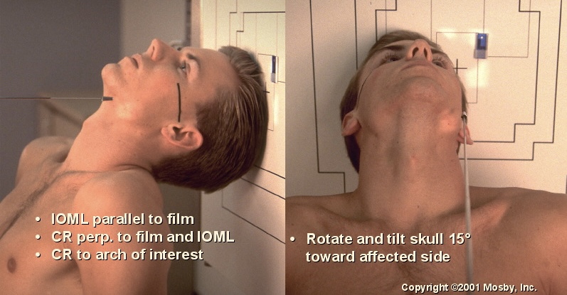 <p>What position is this?</p>