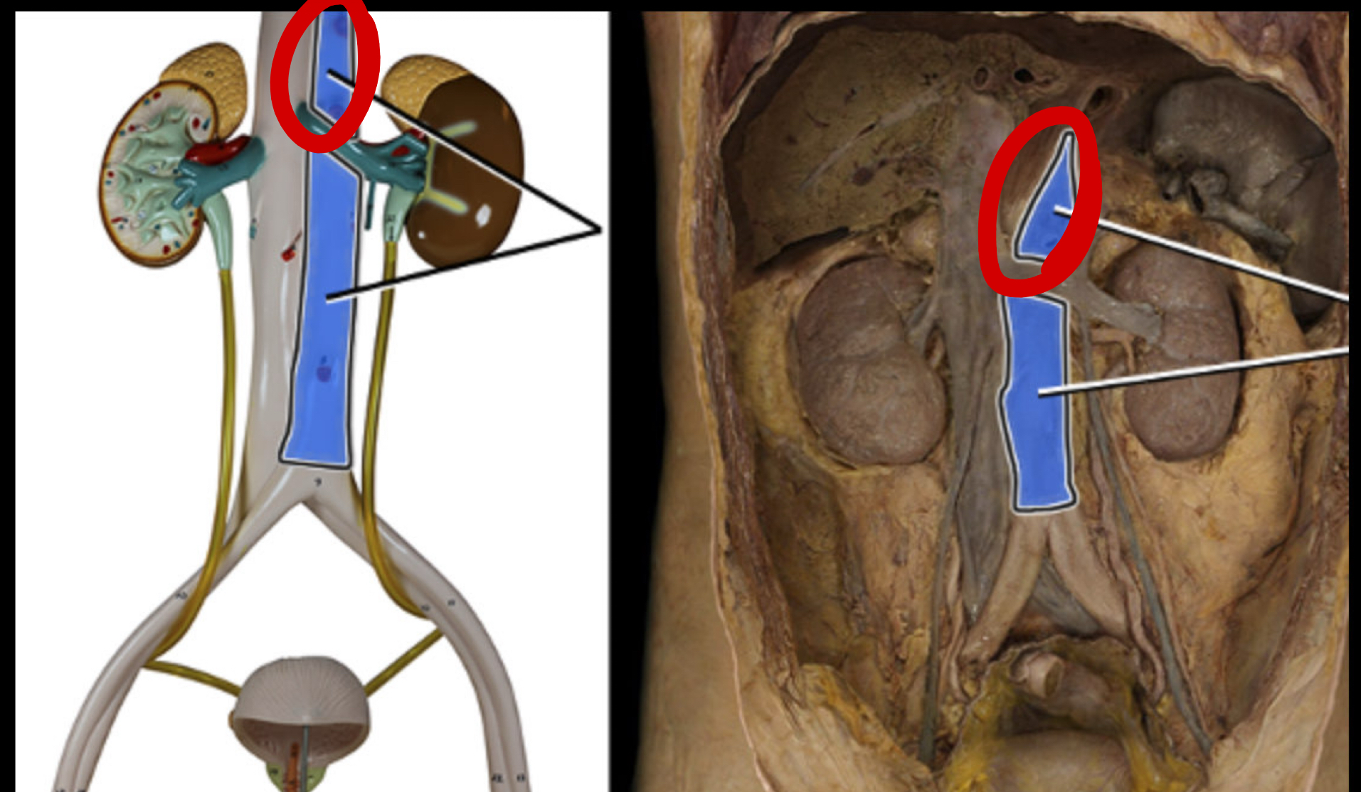 <p>when the aorta passes though the thorax</p>