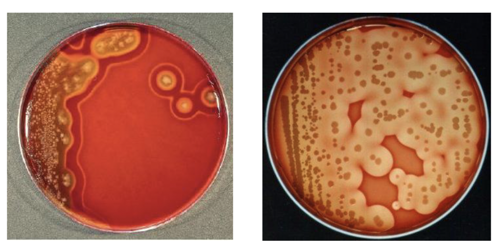 <p>Anaerobic </p>