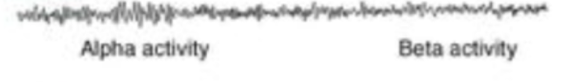 <p>what sleep stage is this EEG recording?</p>