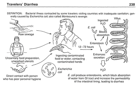 <p>A strain of <em>E. coli</em> that causes<strong> traveler's diarrhea</strong> by producing <strong>enterotoxins that disrupt fluid absorption</strong> in the intestines.</p>