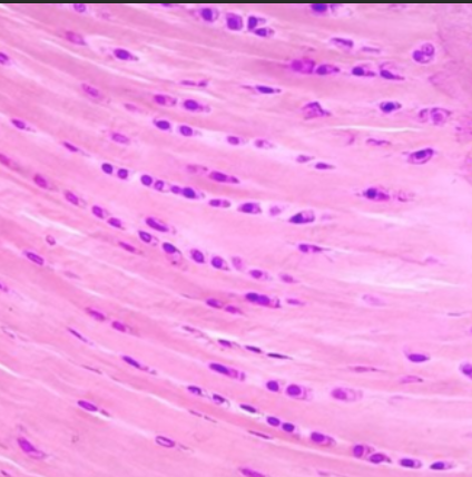 <ul>
<li><strong>High Tensile Strength</strong>: Excellent resistance to pulling forces and compression.</li>
<li><strong>Fiber Composition</strong>: Dense, parallel bundles of thick, <strong>visible Type I collagen</strong> fibers.</li>
<li><strong>Cell Arrangement</strong>: Chondrocytes often arranged in <strong>rows</strong> between collagen bundles.</li>
<li><strong>Locations</strong>: Areas of high stress (intervertebral discs, pubic symphysis, knee menisci).</li>
<li><strong>Perichondrium</strong>: <strong>Lacks a perichondrium</strong> (distinguishing feature).</li>
</ul>
<!-- -->