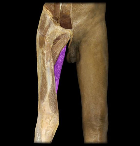 <p>IDENTIFY THIS MUSCLE</p>