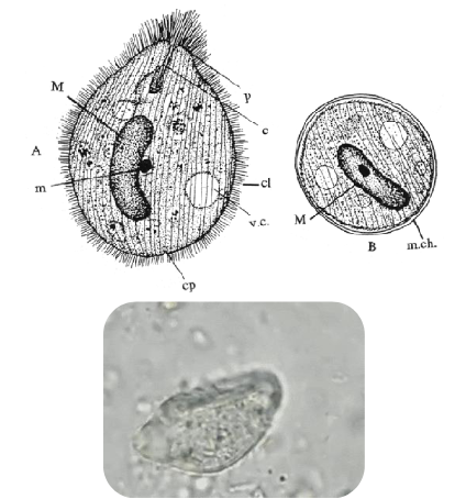 <p>balantidium coli trophozoite </p>
