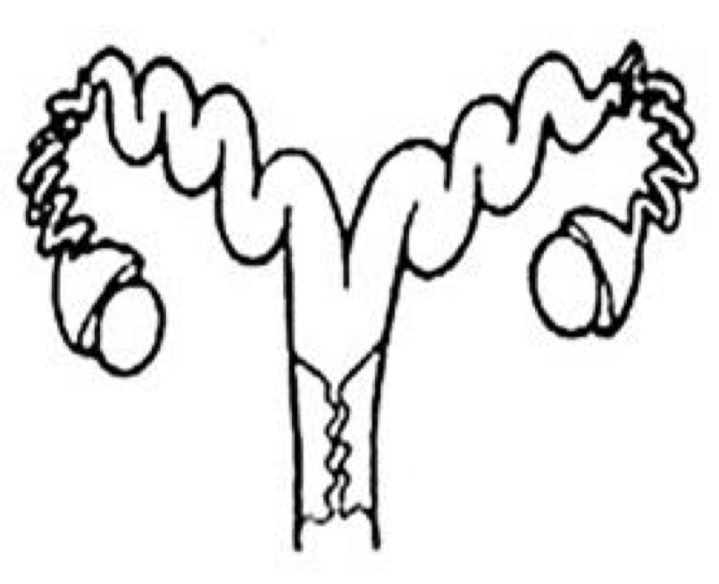 <p>Which uterine classification is this?</p>