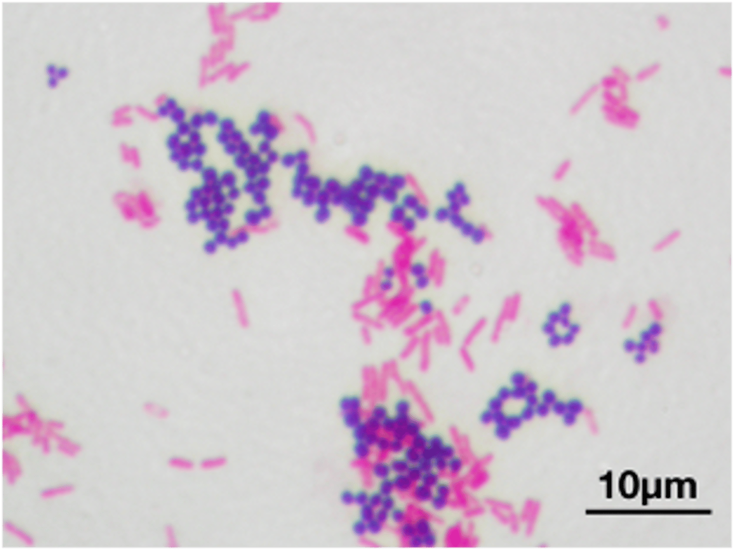 <p>what pathogen is indicated by the gram negative rods in this image</p>