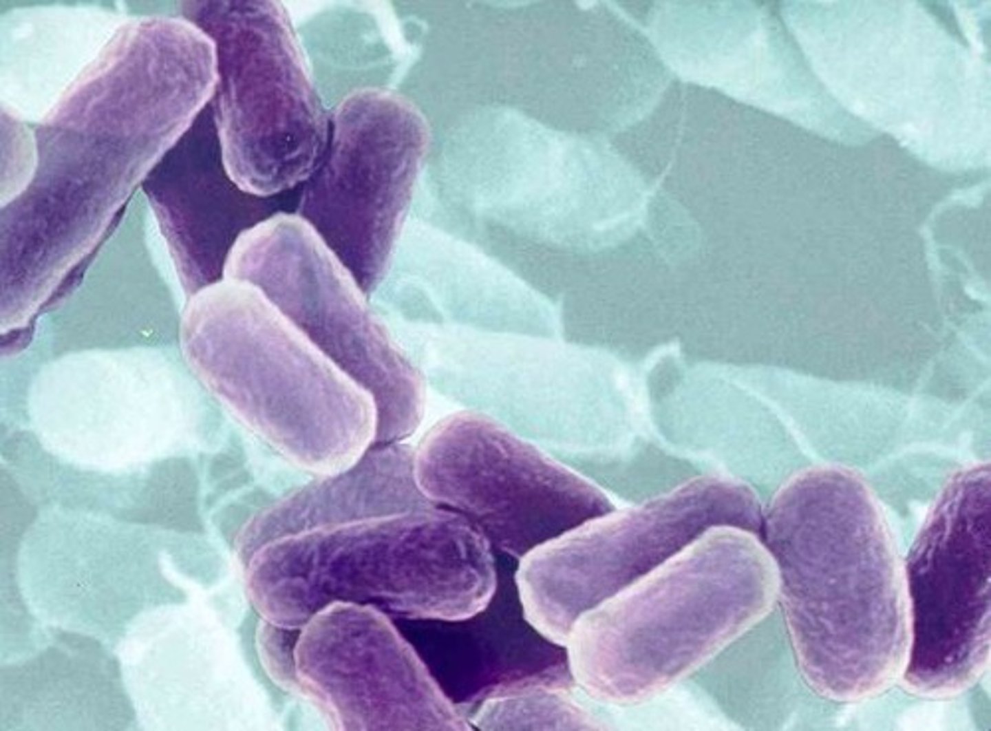 <p>Bacteria</p><p>Viruses</p><p>Fungi</p><p>Parasites</p>