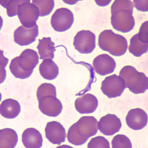 <p>Trypanosoma Brucei Gambiese: Procyclic trypomastigotes</p>