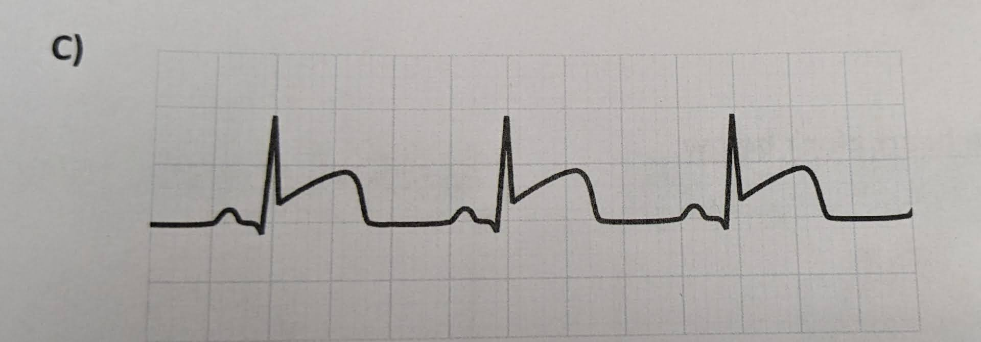 <p>identify the ECG abnormalities (if any)</p>