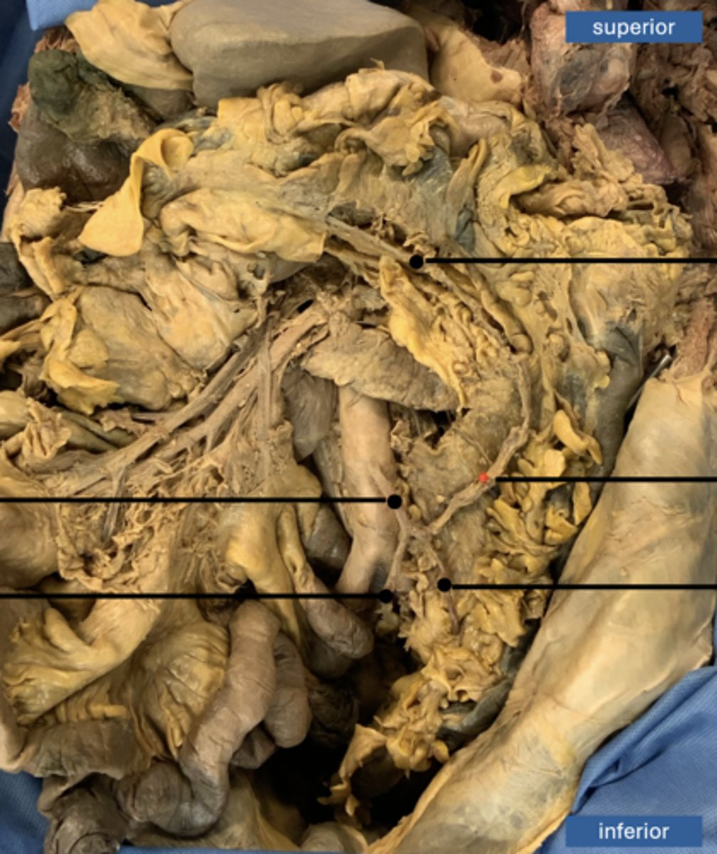 <p>artery</p>