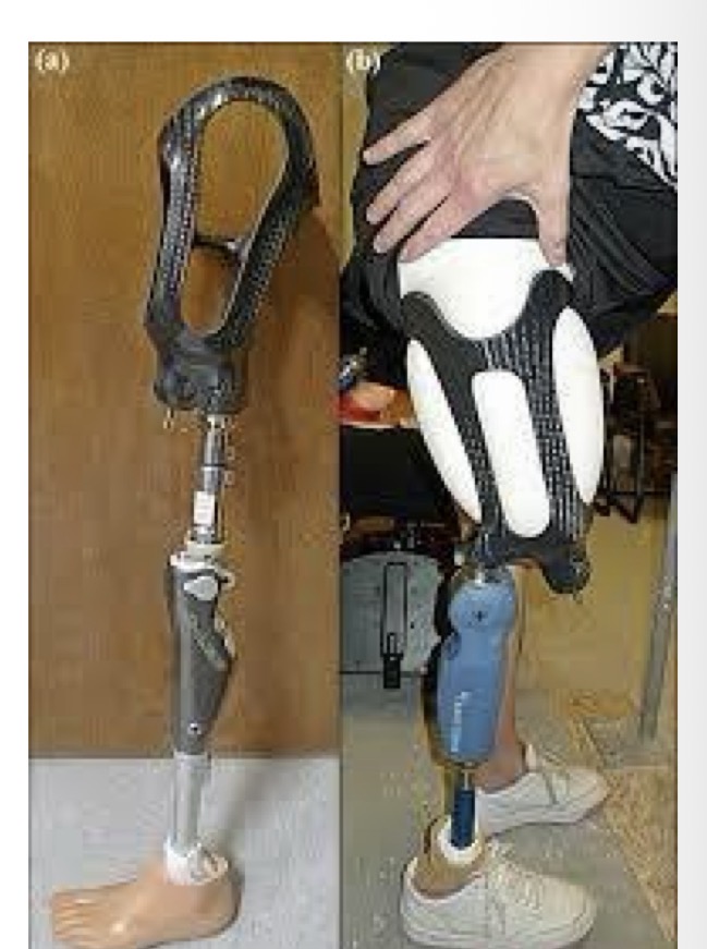 <p>good if pt has significant flexion contracture</p>