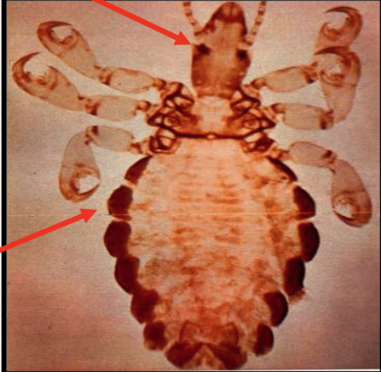 <p>what type of insect is this?</p>