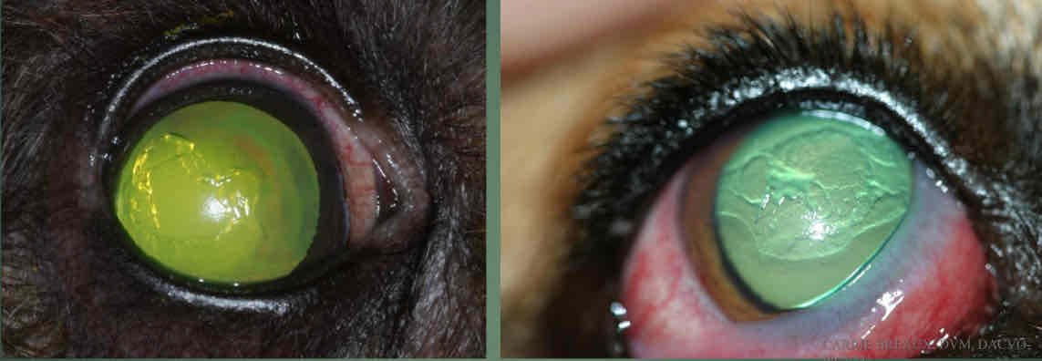 <p>Superifical, loose, non-adherent epithelial flaps. Usually limited vascularization. </p>