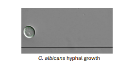 <ol><li><p>Create an <strong>“invasion pocket”</strong></p></li><li><p>Damage cells and tissues by secreting<strong> virulence factors</strong></p></li><li><p>Breach mucosal barriers and <strong>invade underlying tissues</strong></p></li></ol><p></p>