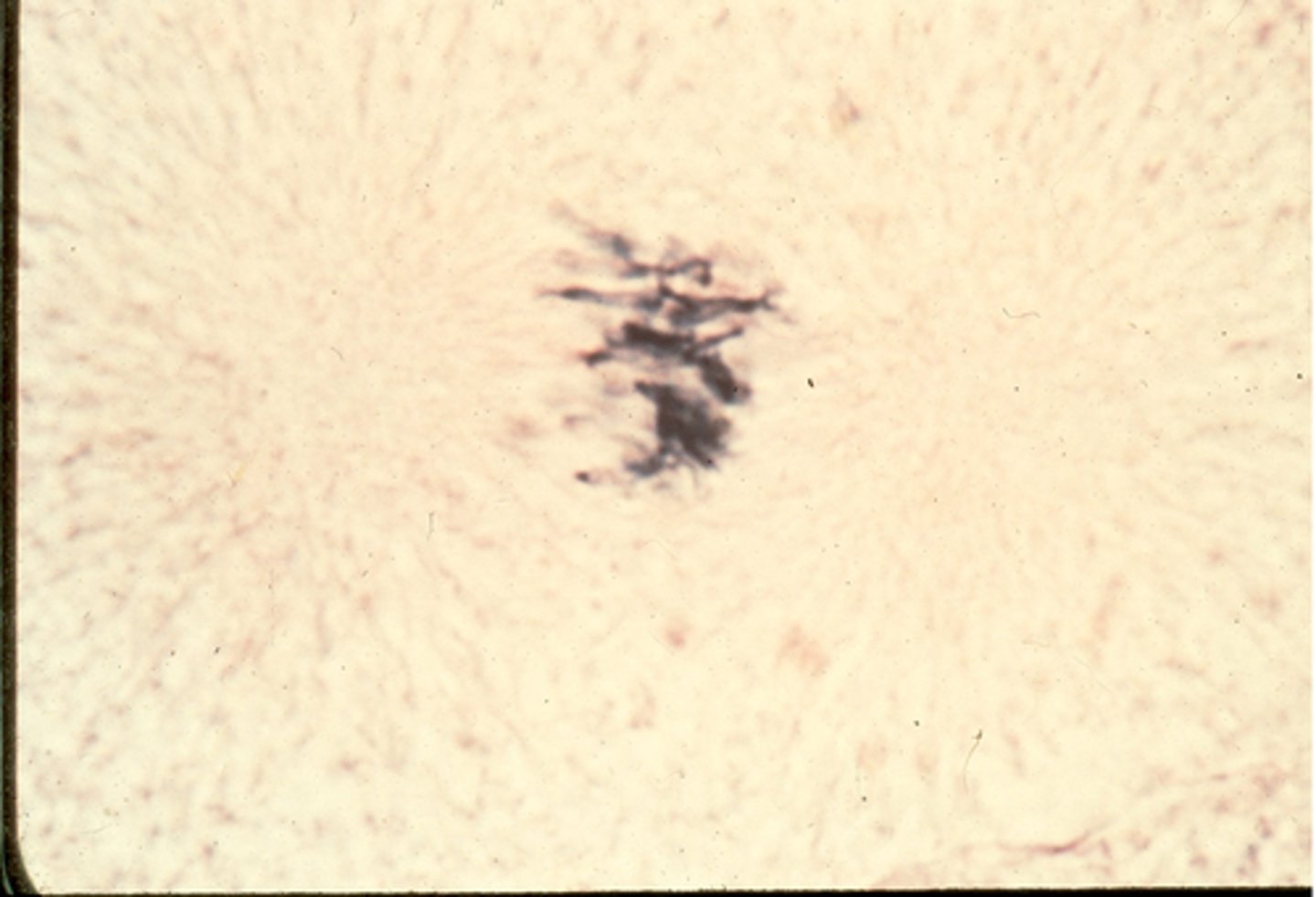 <p>This shows a cell entering ________ in whitefish blastula.</p>
