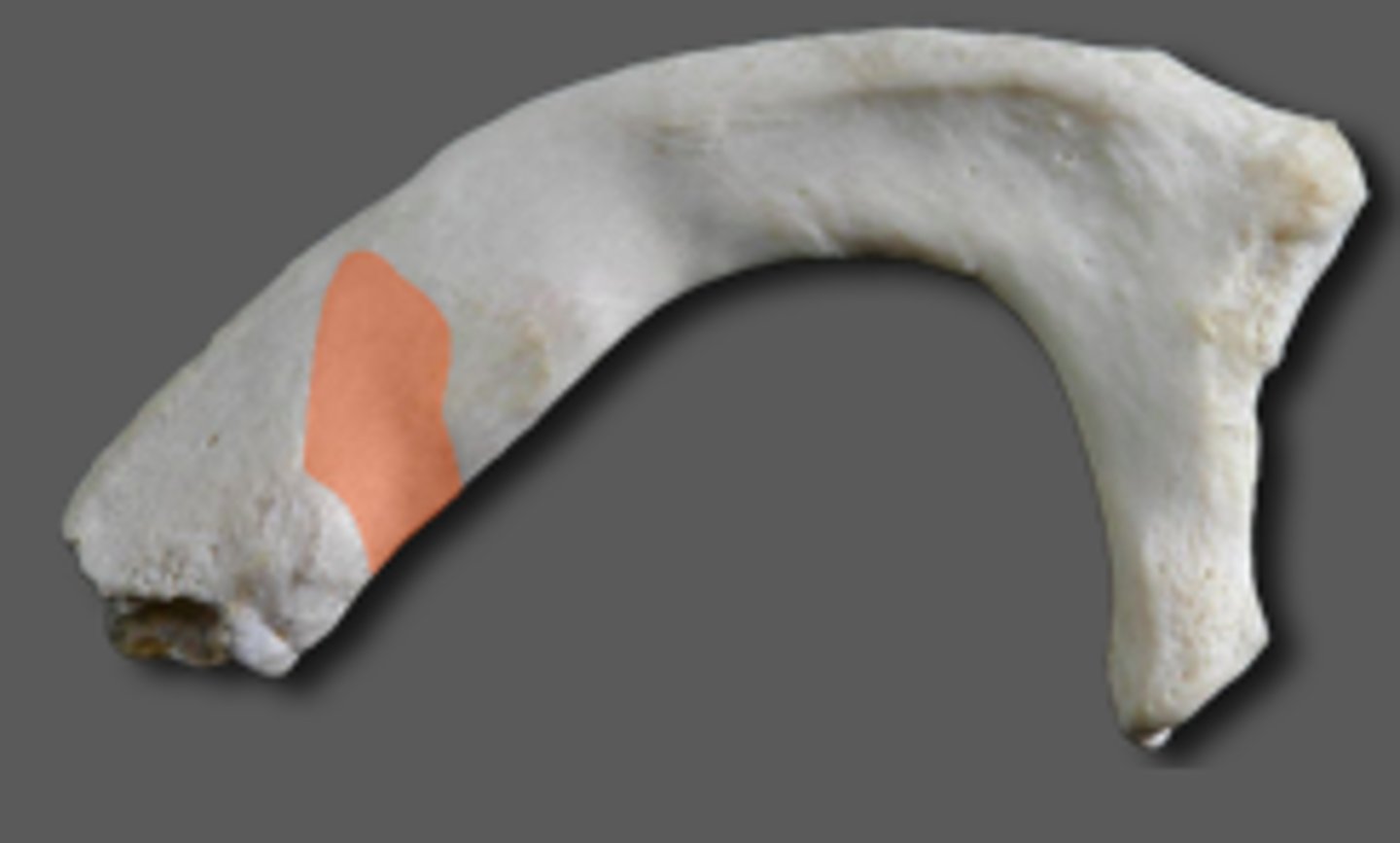 <p>Rib 1</p><p>Just anterior to the scalene tubercle of the first rib</p>