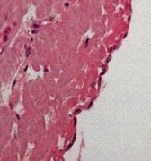 What type of epithelia? Where could it be located?