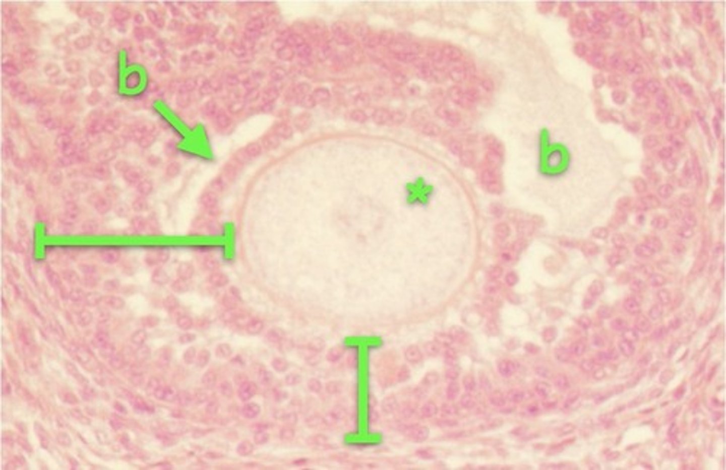 <p>* (upper right)</p>